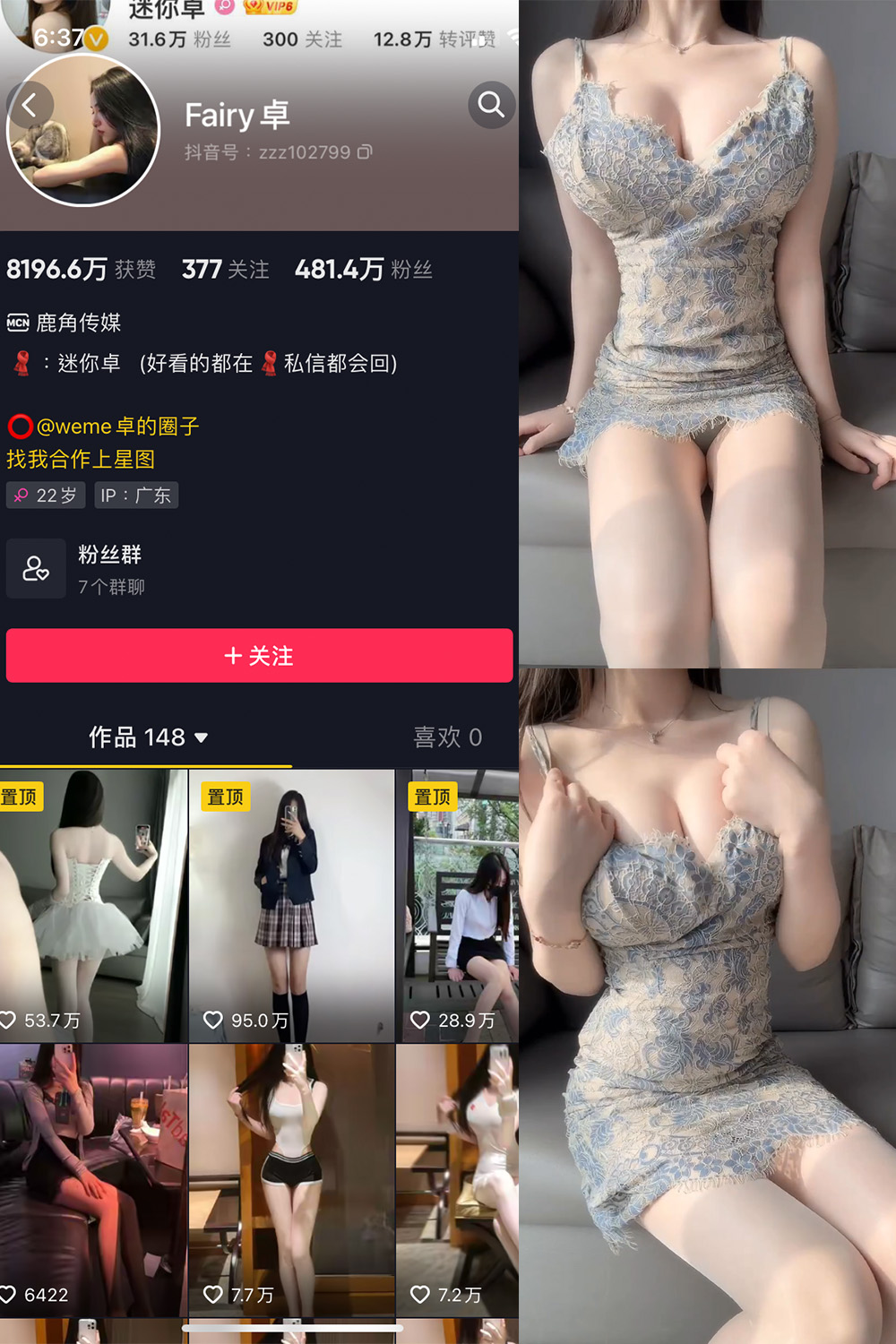 Fairy卓 微密圈 NO.010期-微密秀-微密圈秀人铁粉空间抖音网红圈主资源